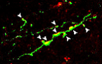 Neurociències