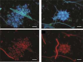 Microfotografies fetes amb microscopi de fluorescència.