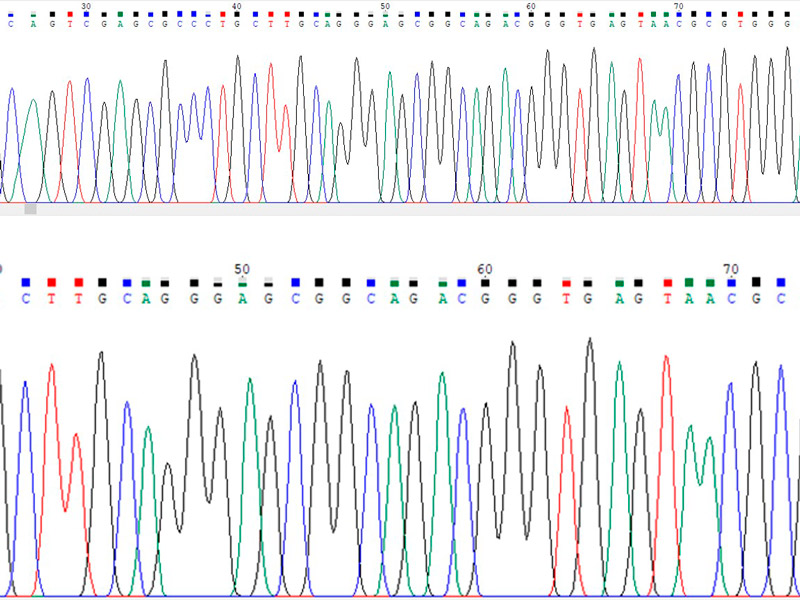 Identificación microbiana