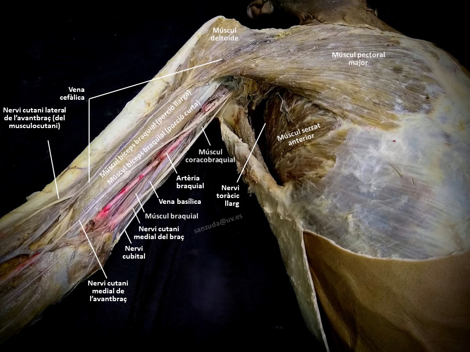 Dissecció de la cara anterior del braç i l'axil·la Dissecció de la cara anterior del braç i l'axil·la