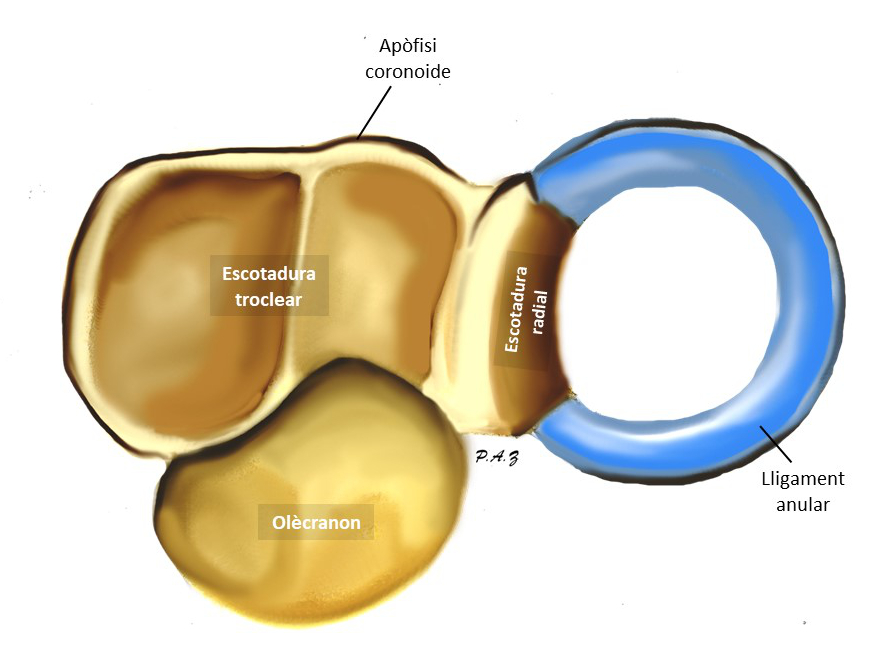 Extremitat proximal del cúbit i lligament anular del radi (vista proximal) Il·lustració de l'extremitat proximal del cúbit amb el lligament anular del radi i sense el cap del radi