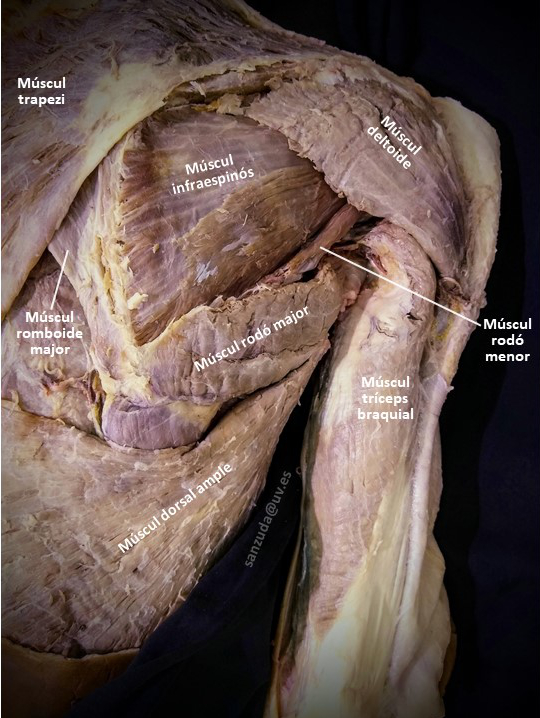 Dissecció de la musculatura posterior de l'escàpula i el braç Dissecció de la musculatura posterior de l'escàpula i el braç