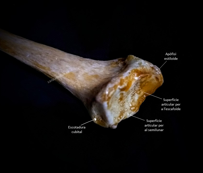 Extremitat distal del radi (vista distal i anterior) Fotografia de l'extremitat distal del radi, vista distal i anteriorment, amb els accidents més importants retolats