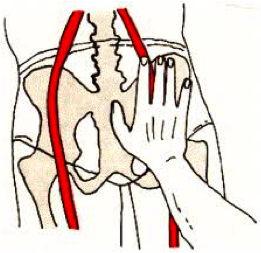 Presión arteria femoral