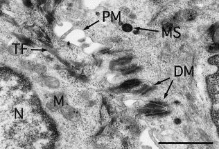 Ishiko A. Electron mycroscopy in diagnosis of autoimmune bullous disordes. Clinics in Dermatol 2001, 19:631