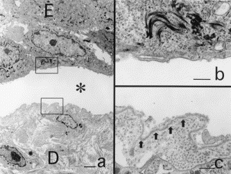 Ishiko A. Electron mycroscopy in diagnosis of autoimmune bullous disordes. Clinics in Dermatol 2001, 19:631